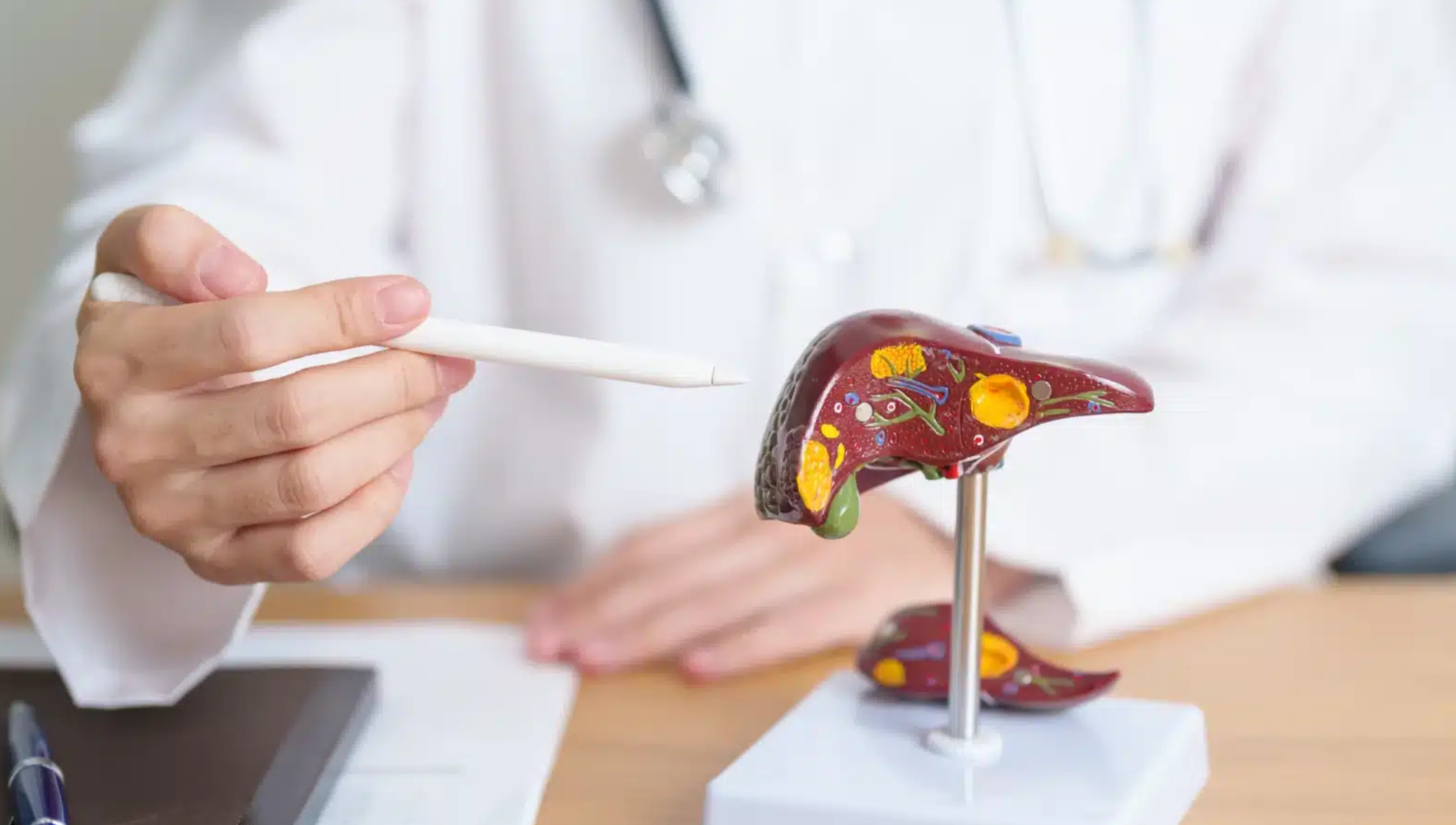 Met omega-3-vetten tegen leververvetting?